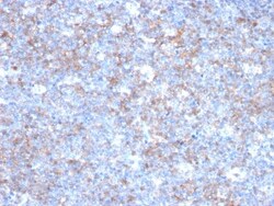 MCAM/CD146 Antibody (C146/634), Novus Biologicals 0.2mg; Unlabeled:Antibodies,